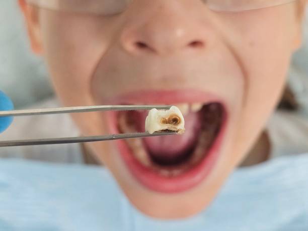 Best Emergency Treatment for Dental Infections or Abscesses in Newville, PA