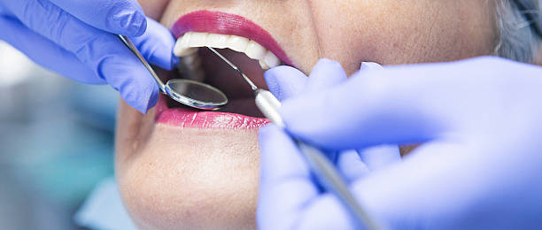 Best Emergency Dental Care for Broken or Chipped Teeth in Newville, PA